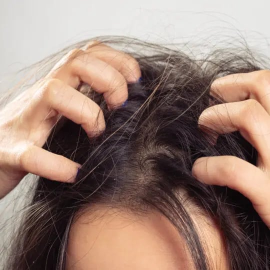 what to do if you find bed bugs in your hair