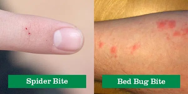 spider bite vs bed bug bite